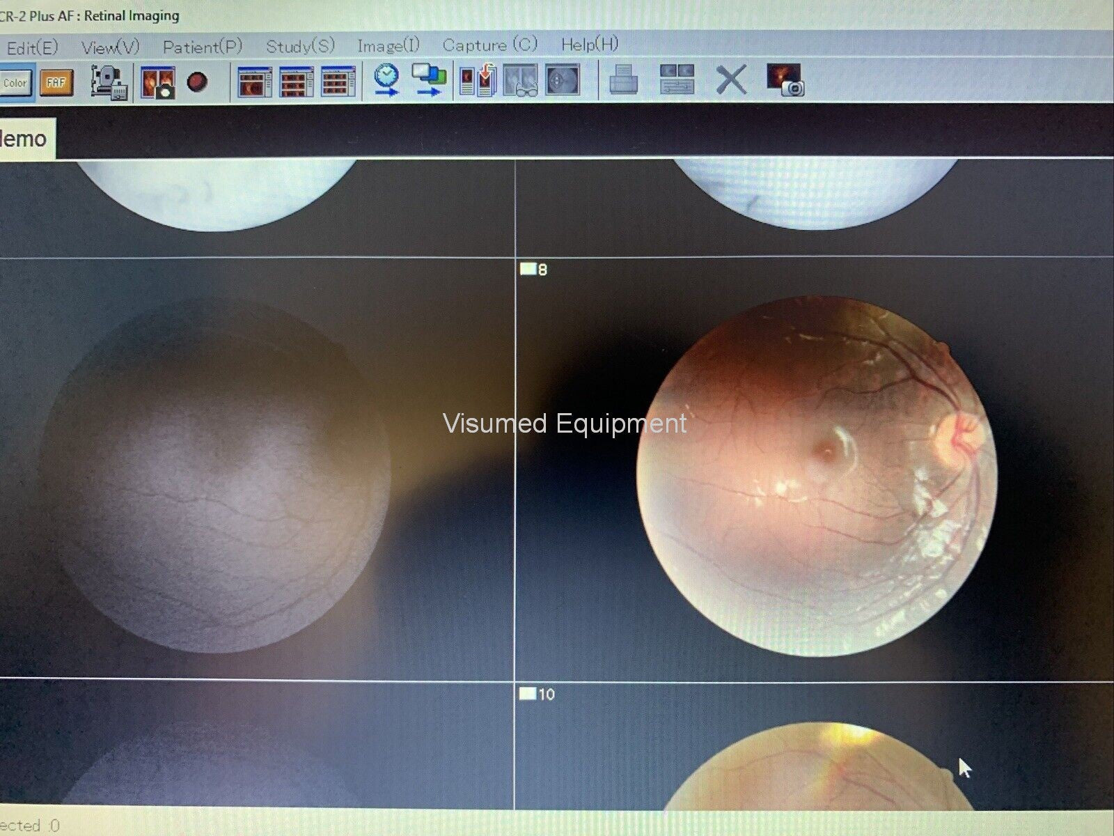 Refurbished Canon CR-2 Plus AF Camera Autofocus Fundus Autofluorescence offered by Visumed Equipment