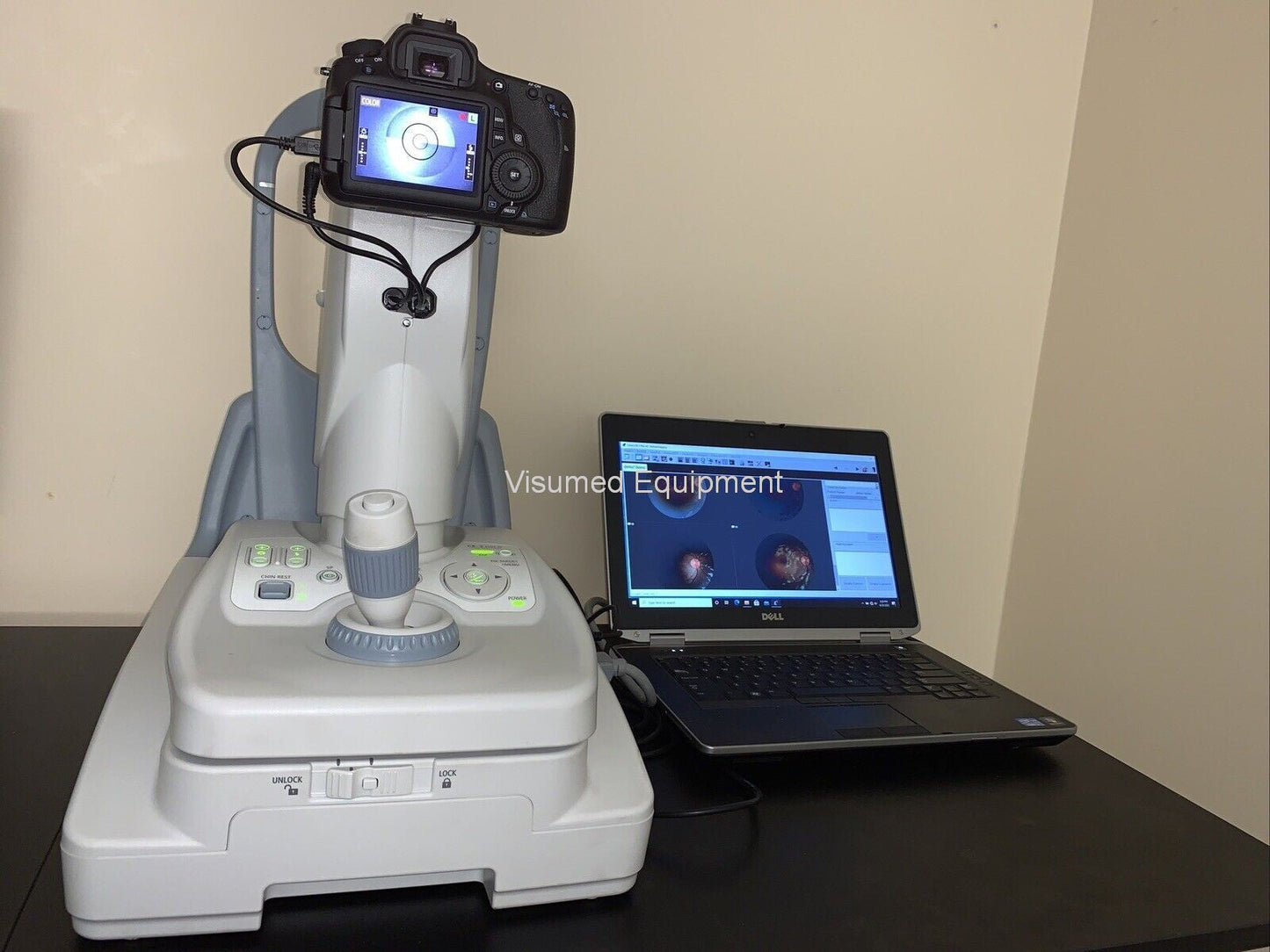 Refurbished Canon CR-2 Plus AF Camera Autofocus Fundus Autofluorescence offered by Visumed Equipment