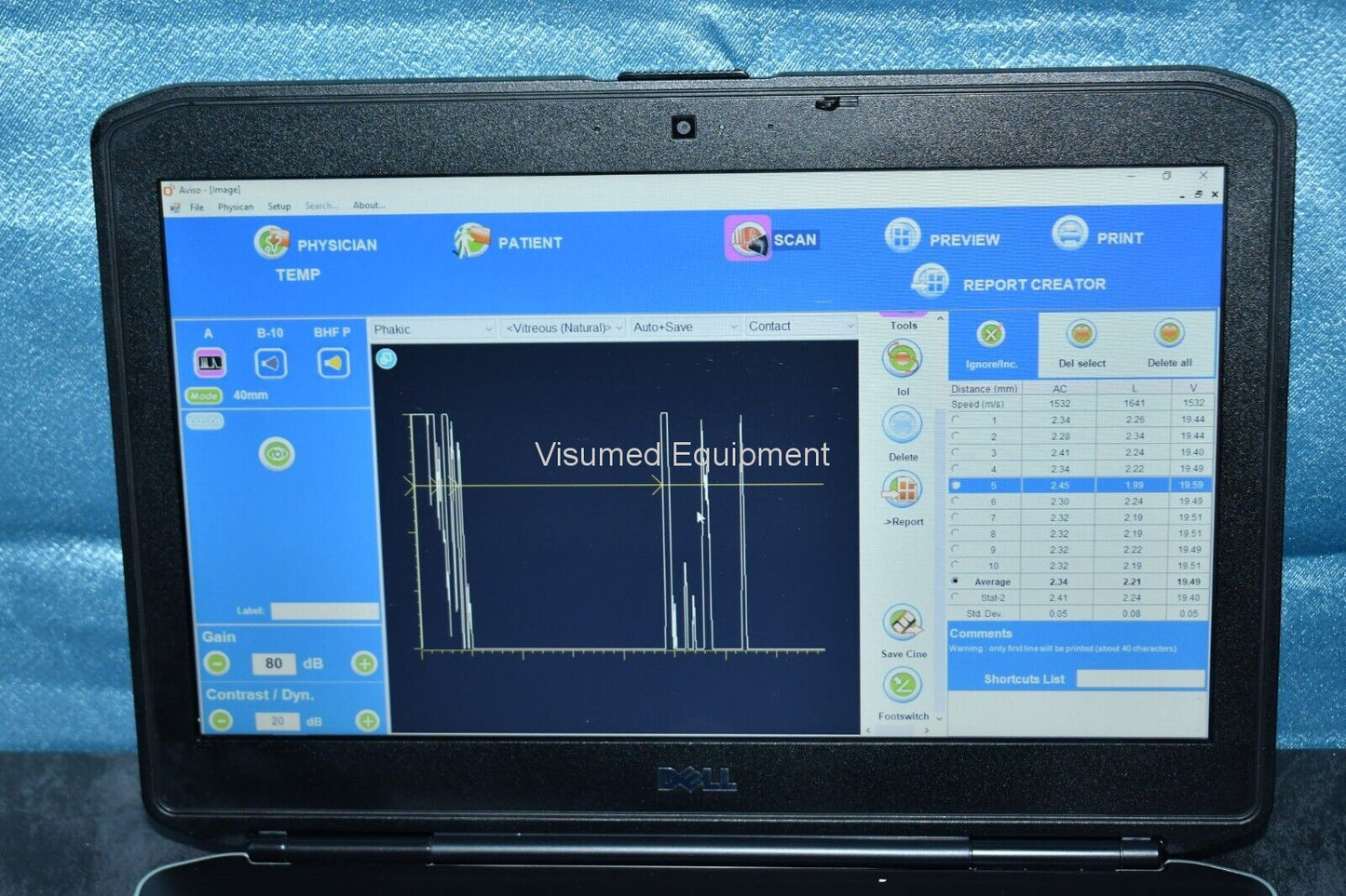 Refurbished Quantel Medical Aviso A and B scan Ultrasound complete offered by Visumed Equipment