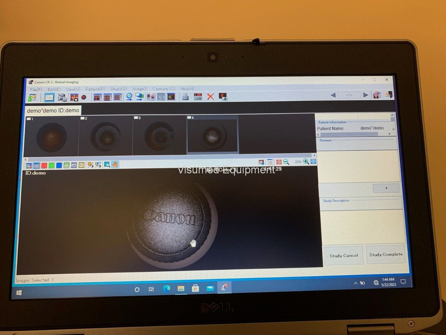 Refurbished Canon CR-2 Retinal Camera +dell laptop windows 10 & Canon Software offered by Visumed Equipment