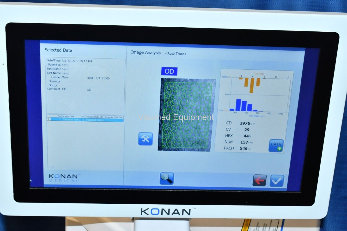 Refurbished Konan CellChek SL Specular microscope pachymeter offered by Visumed Equipment