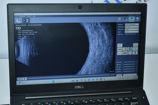 DGH Scanmate Flex B-scan - photo 2