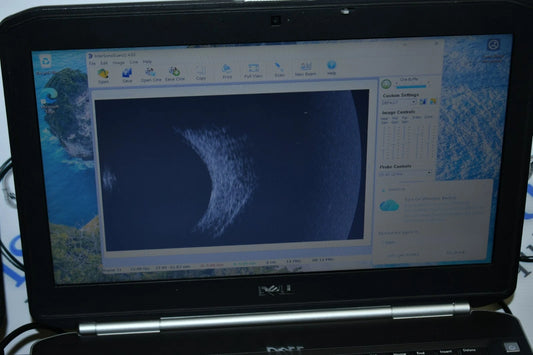 MMD PalmScan A2000 Ophthalmic B-scan photo 2
