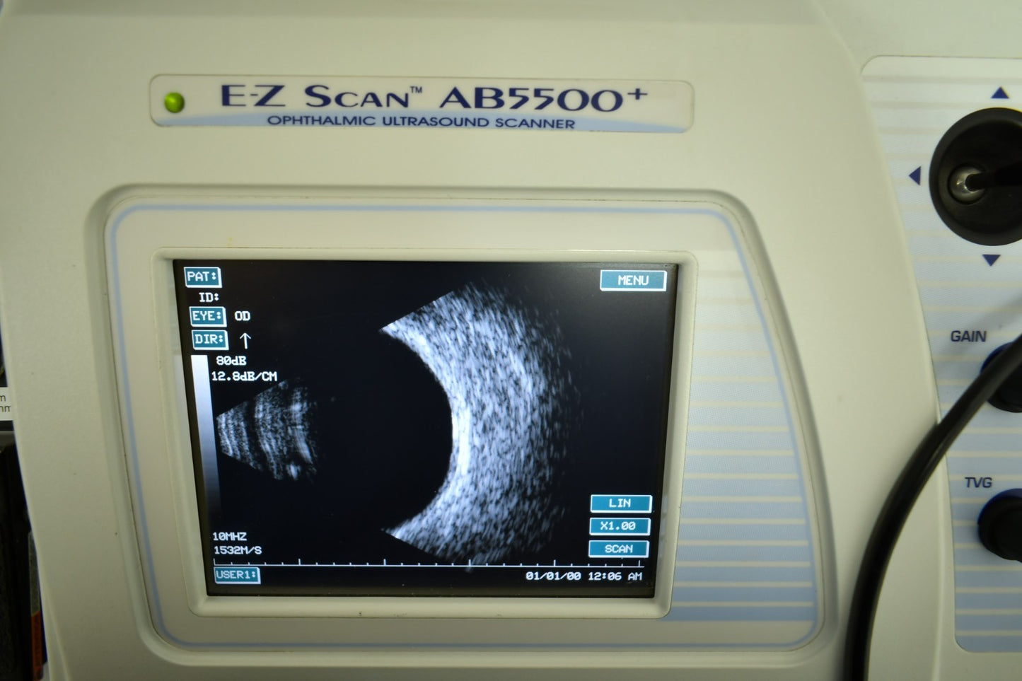 Sonomed EZ Scan AB5500+ probes and accessories