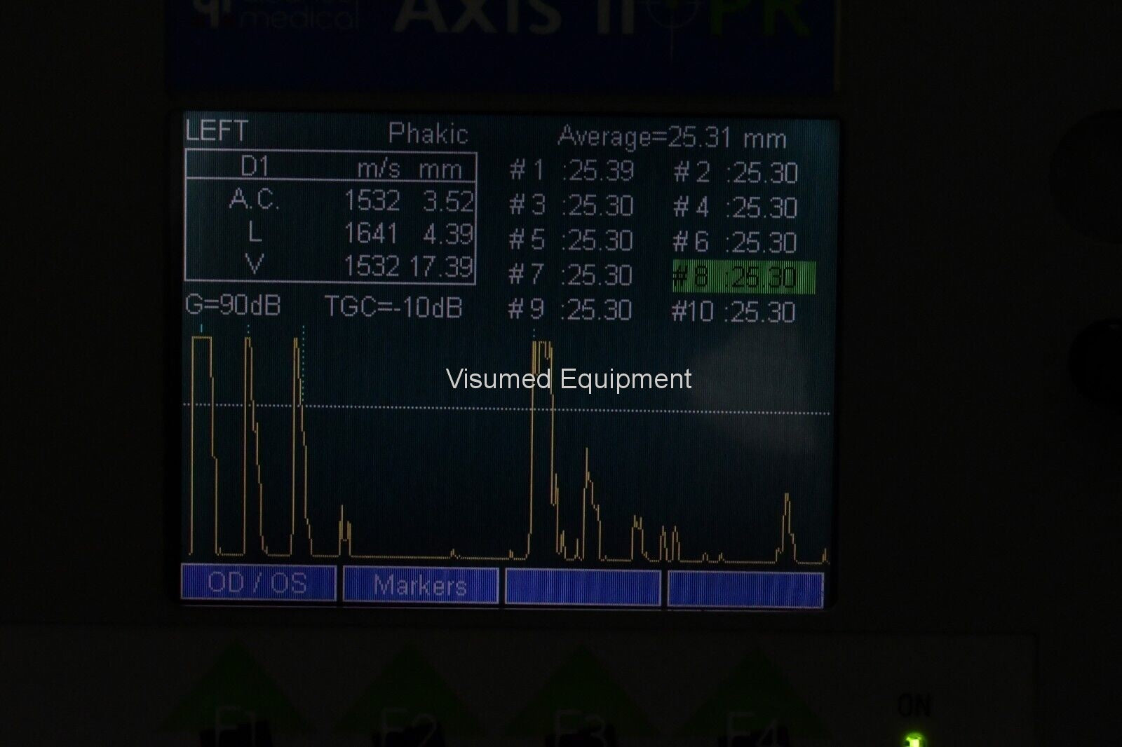 Quantel Medical Axis II PR Ultrasound Biometer