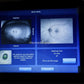 Optos Daytona RG AF  retinal Camera-Visumed Equipment