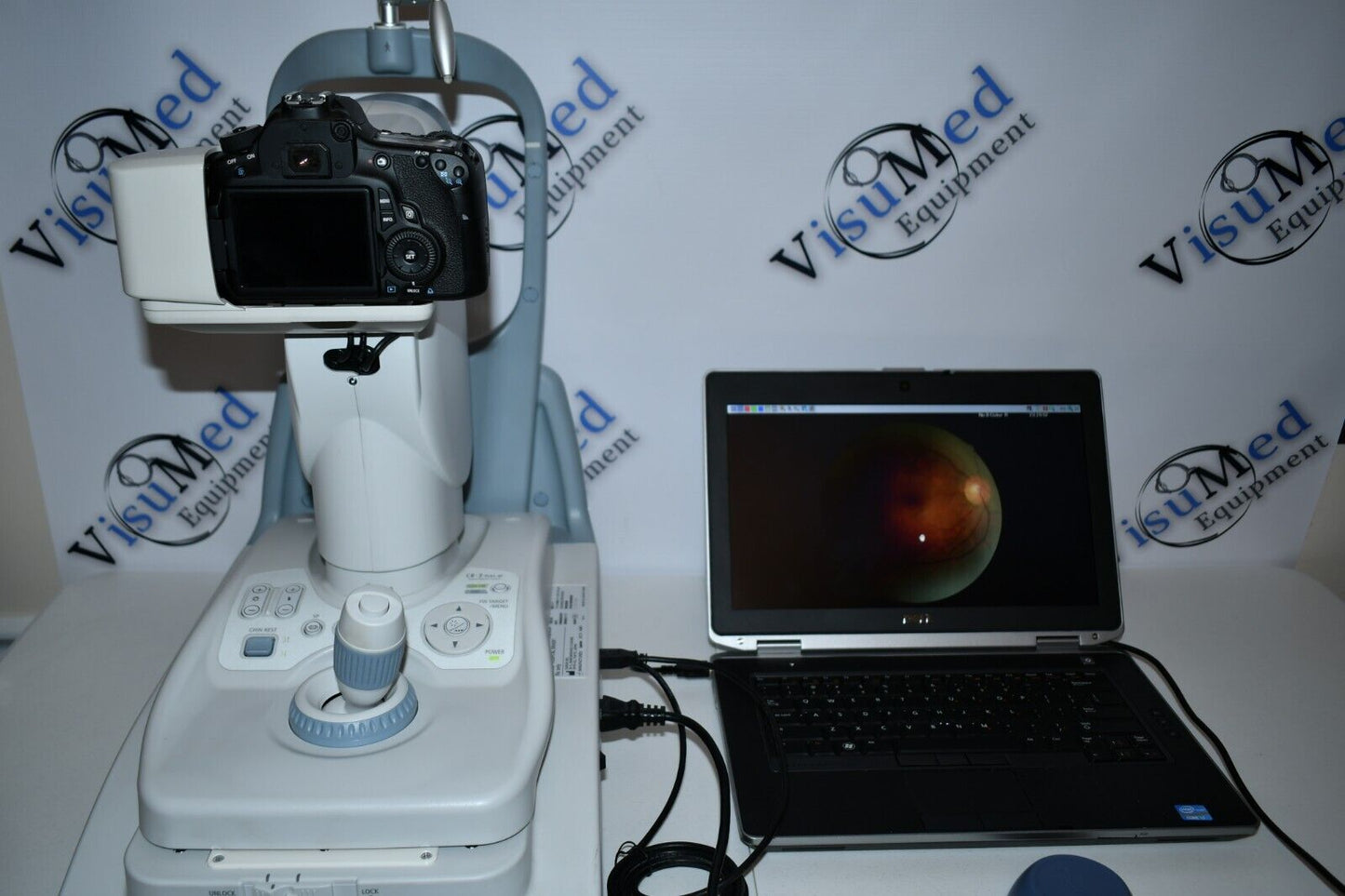 Canon CR-2 Plus AF Camera Autofocus Fundus Autofluorescence