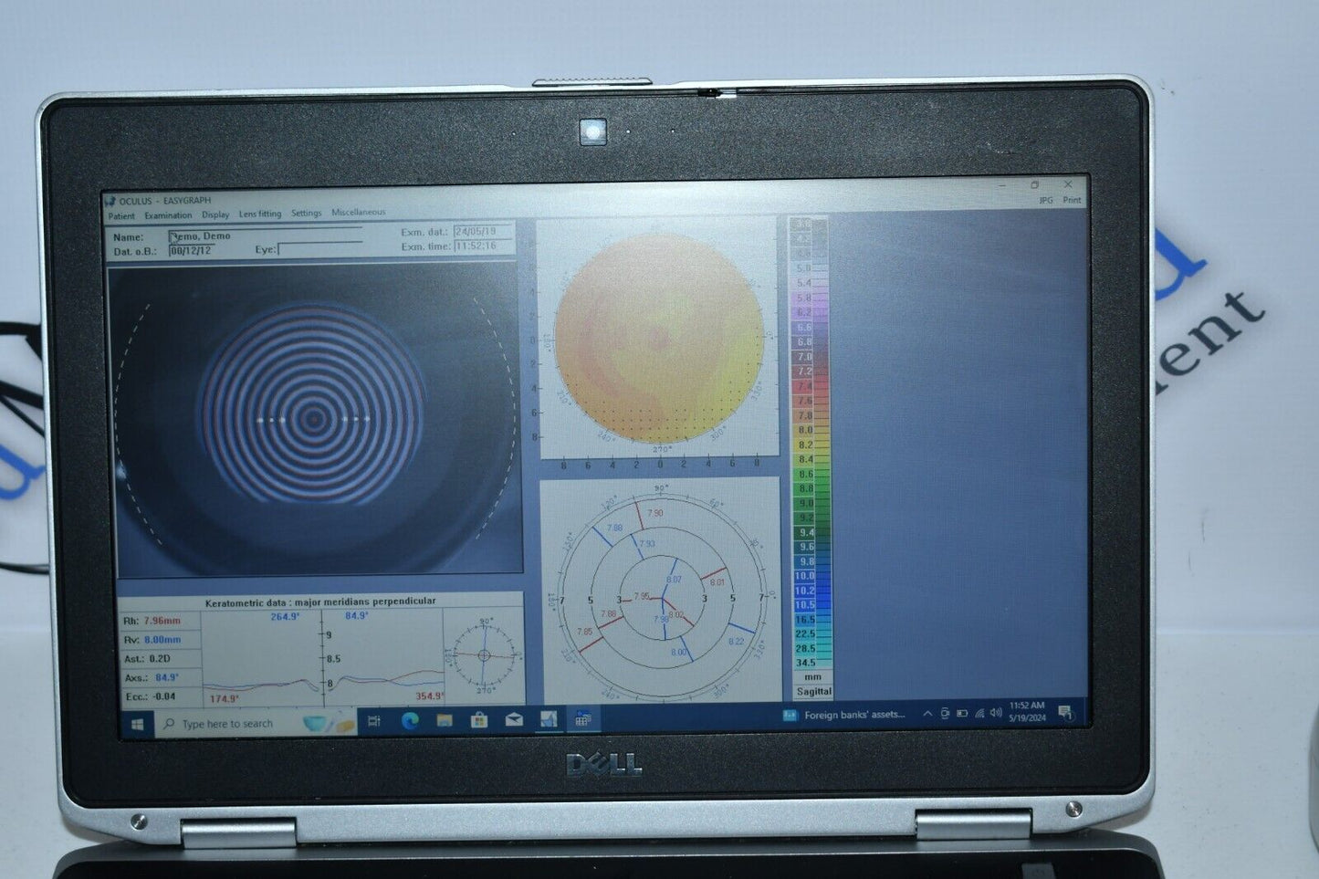 Oculus Easygraph Corneal topographer portable/slitlamp mountable