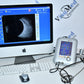Quantel Aviso S Diagnostic Ascan and Bscan Ophthalmic ultrasound