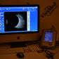 Quantel Aviso S Diagnostic Ascan and Bscan Ophthalmic ultrasound