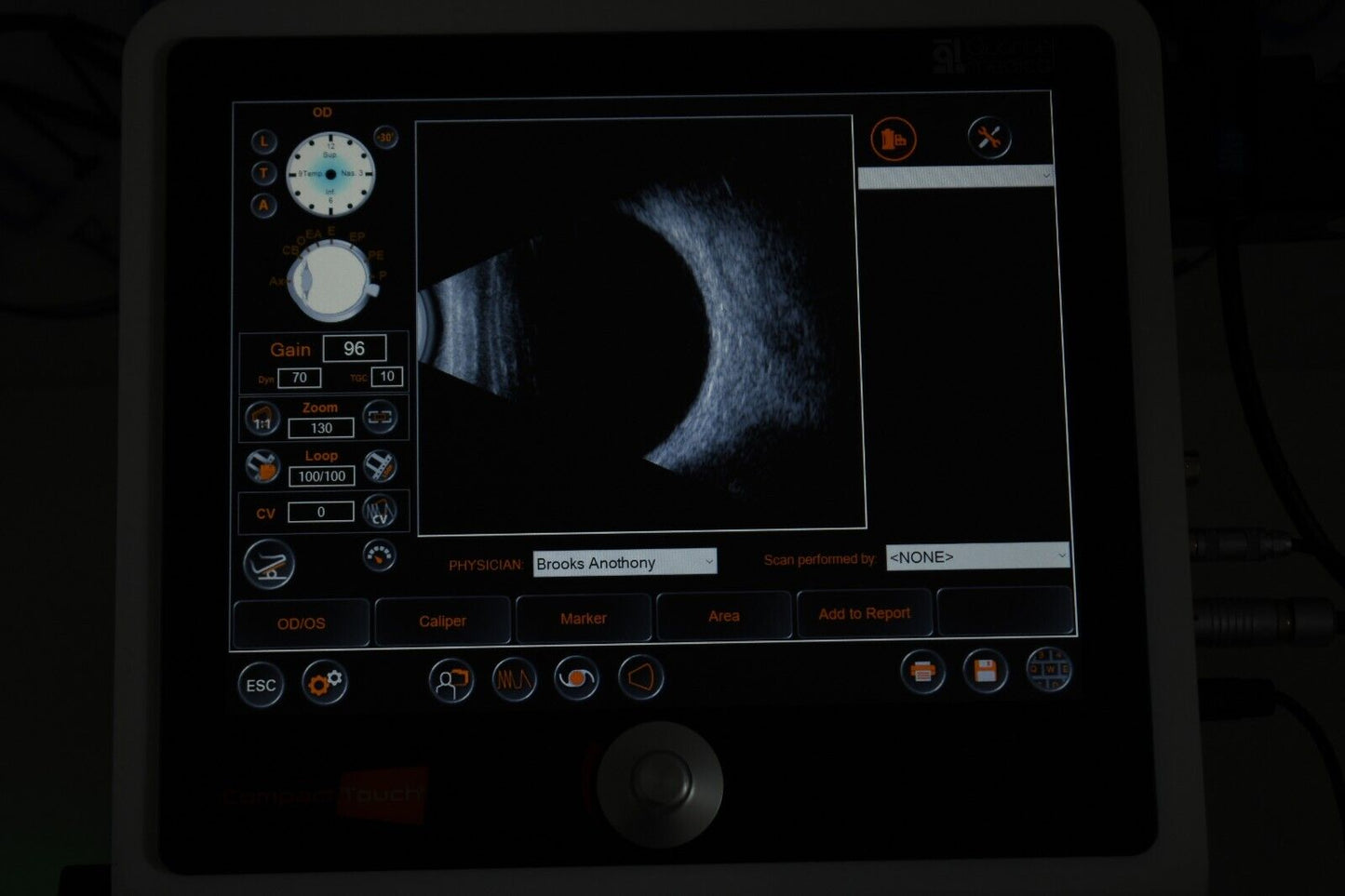 Quantel compact touch 2 touch scan A scan B scan ophthalmic ultrasound