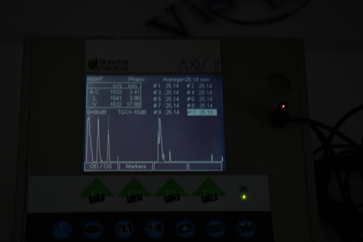 QUANTEL MEDICAL AXIS II PR Ultrasound A-Scan  Biometer