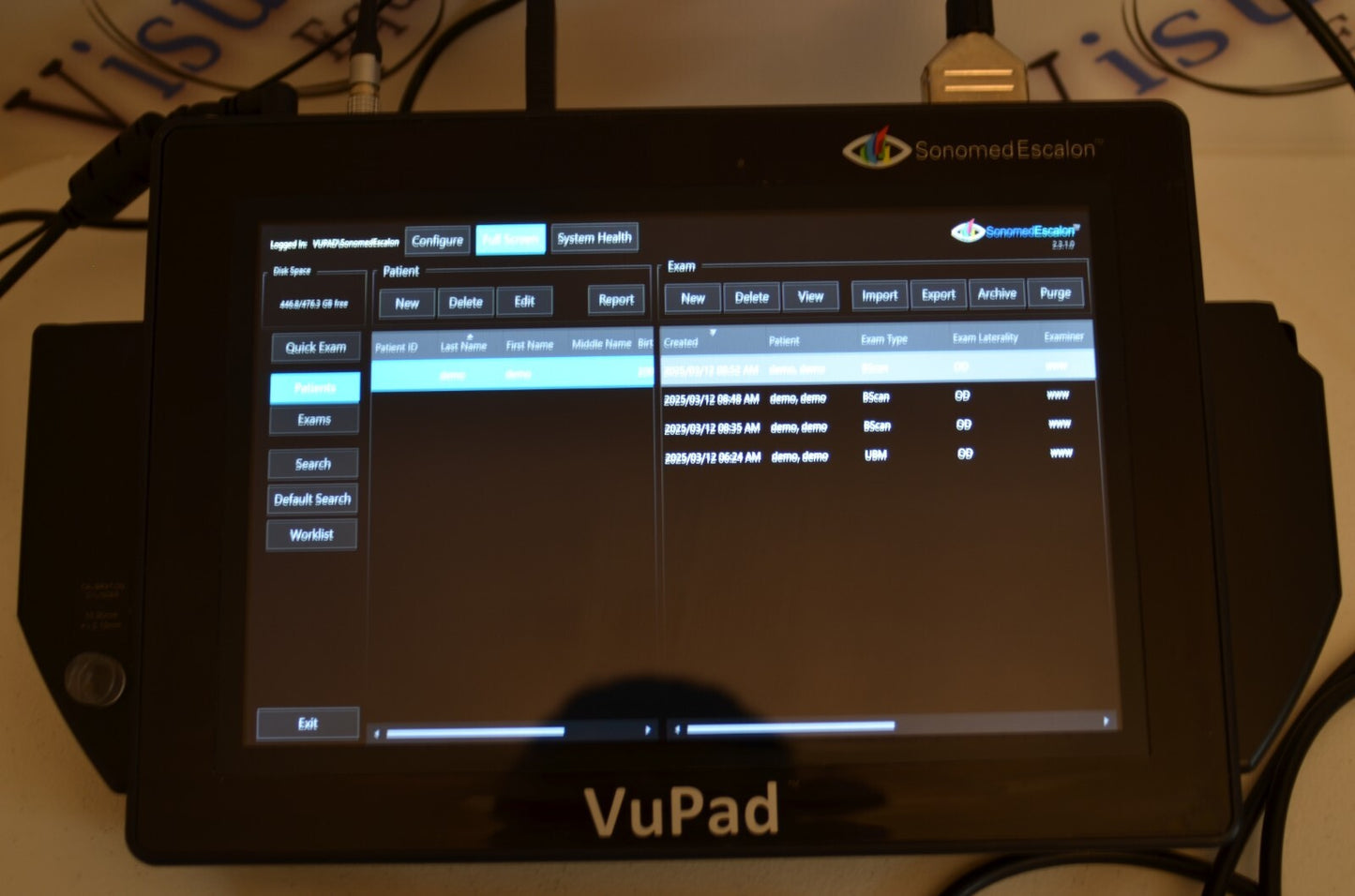 Sonomed  Escalon Vupad  A-scan B-scan and UBM
