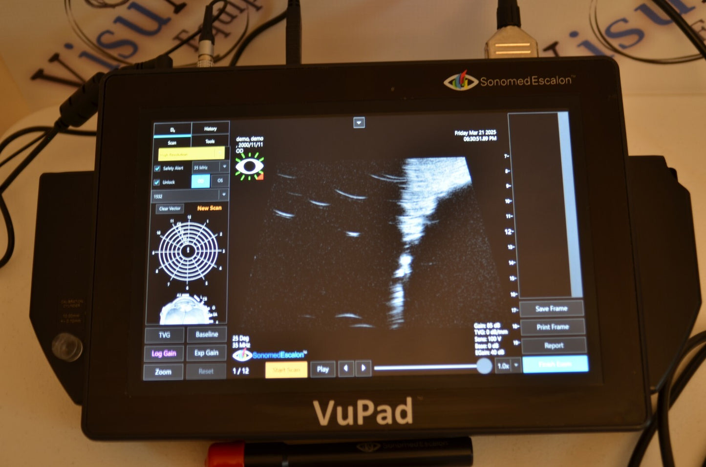 Sonomed  Escalon Vupad  A-scan B-scan and UBM