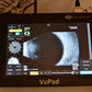 Sonomed  Escalon Vupad  A-scan B-scan and UBM