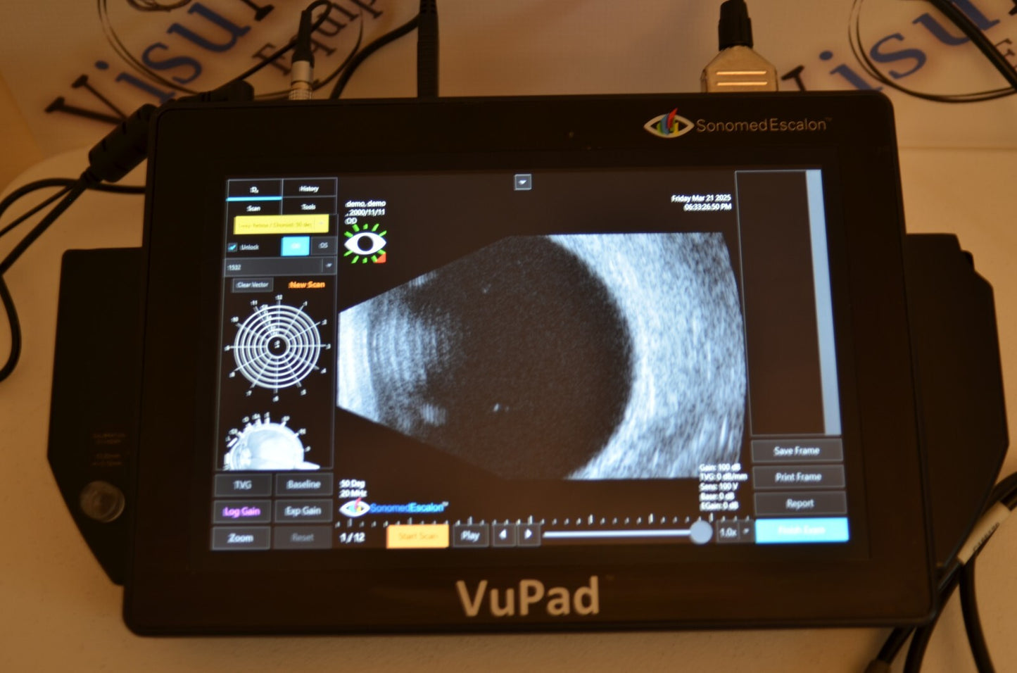 Sonomed  Escalon Vupad  A-scan B-scan and UBM