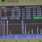 Refurbished QUANTEL MEDICAL AXIS II Ultrasound A-Scan  Biometer offered by Visumed Equipment