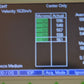 Refurbished QUANTEL MEDICAL AXIS II Ultrasound A-Scan  Biometer offered by Visumed Equipment