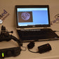 HEINE OMEGA 500 LED ophthalmoscope with DV1 Digital Video fundus Camera