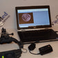 HEINE OMEGA 500 LED ophthalmoscope with DV1 Digital Video fundus Camera