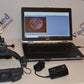 HEINE OMEGA 500 LED ophthalmoscope with DV1 Digital Video fundus Camera