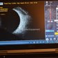 Refurbished Accutome Keeler B-scan plus ultrasound offered by Visumed Equipment