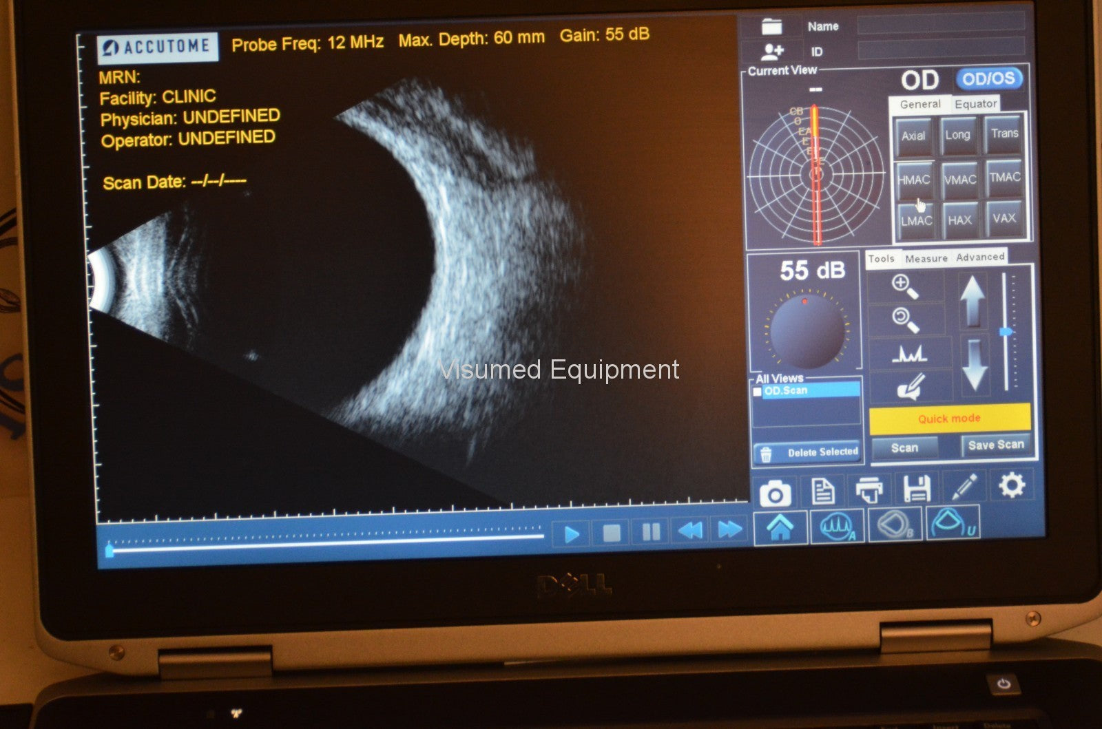 Refurbished Accutome Keeler B-scan plus ultrasound offered by Visumed Equipment
