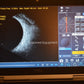 Refurbished Accutome Keeler B-scan plus ultrasound offered by Visumed Equipment