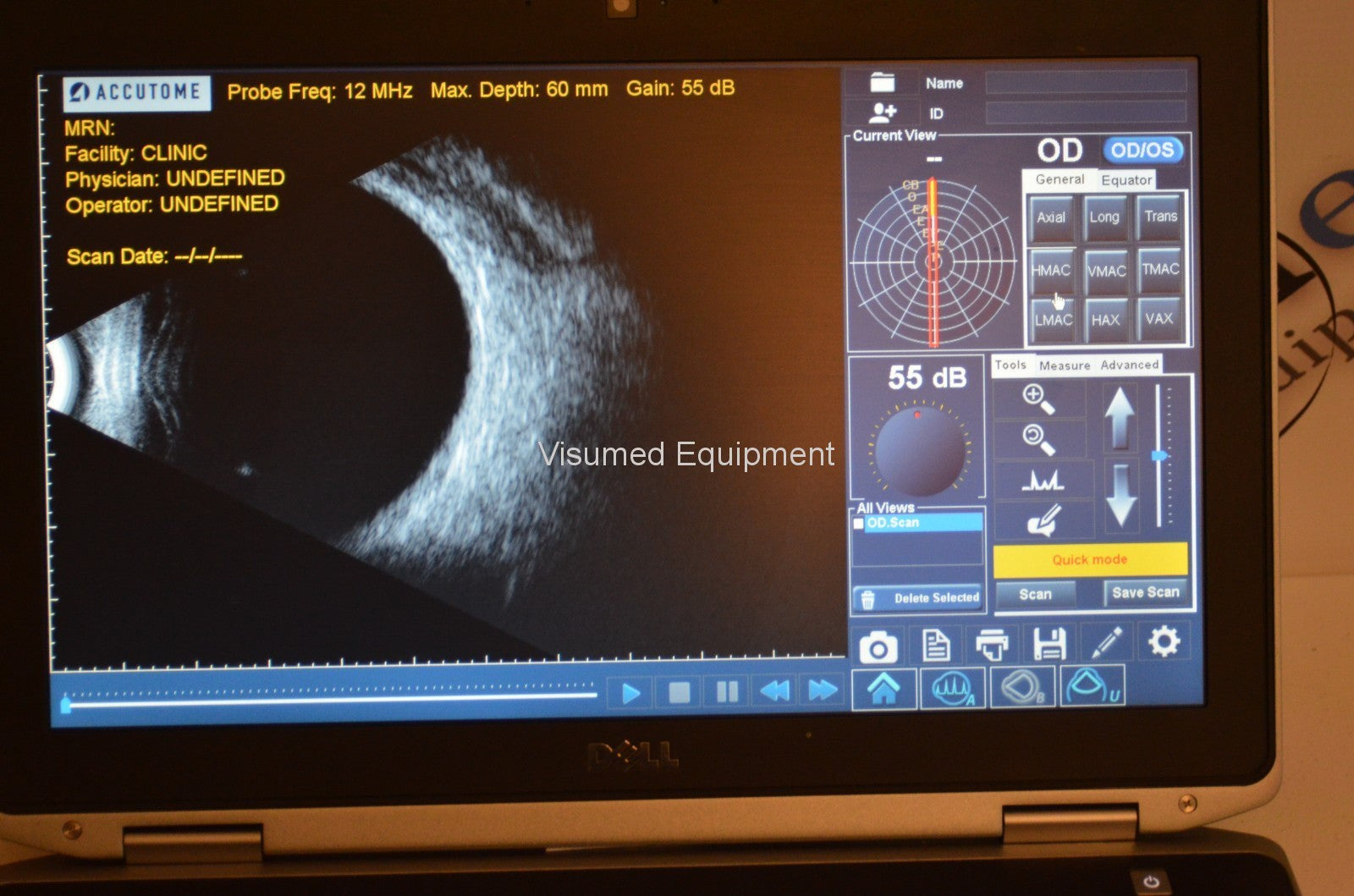 Refurbished Accutome Keeler B-scan plus ultrasound offered by Visumed Equipment