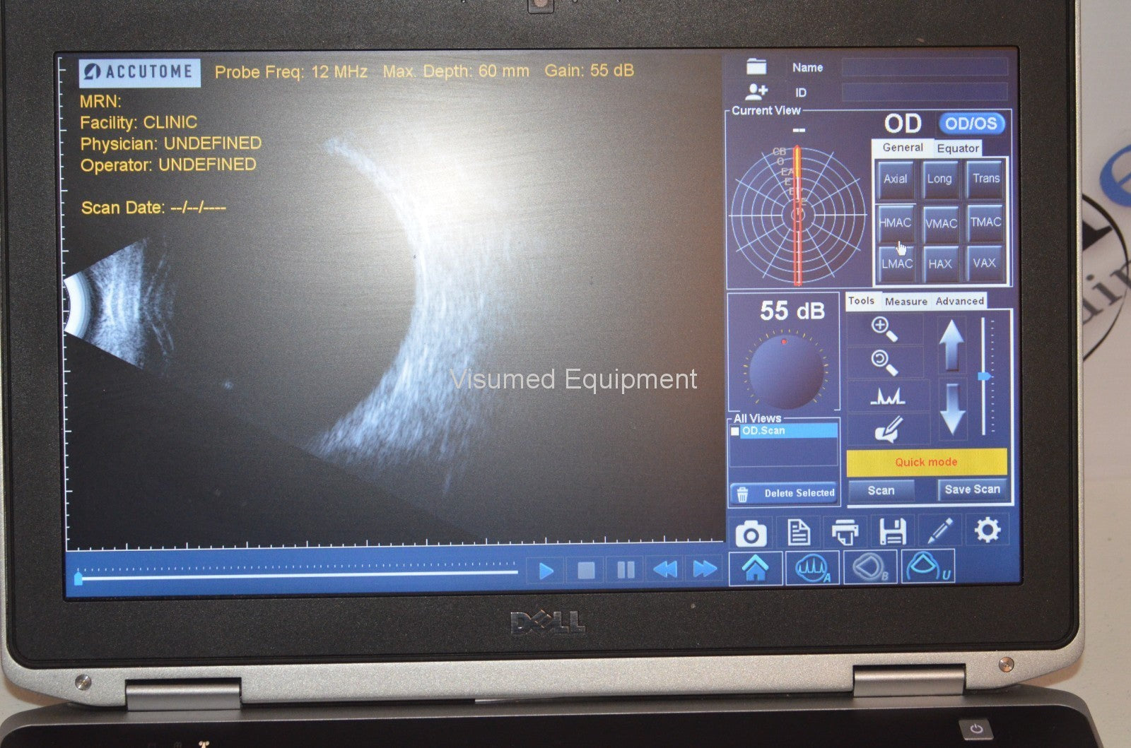 Refurbished Accutome Keeler B-scan plus ultrasound offered by Visumed Equipment