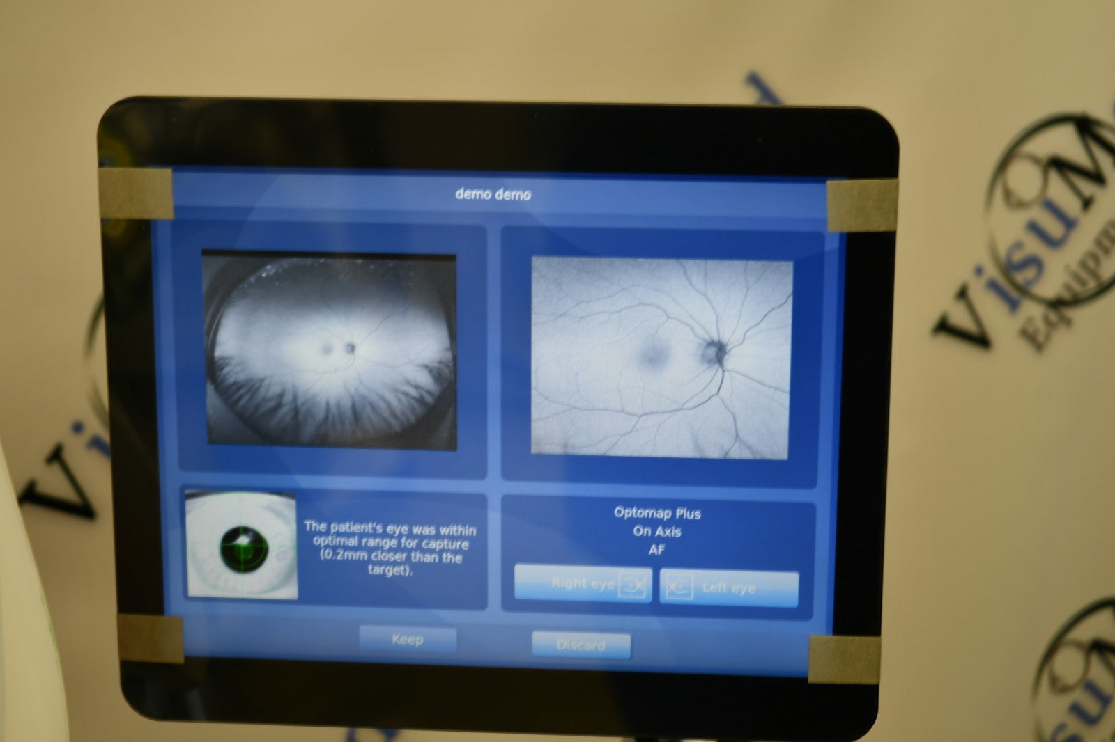 Refurbished Optos Daytona 2021 RG AF retinal fundus Camera offered by Visumed Equipment