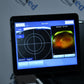 Refurbished Optos California RG AF FFA ICG retinal Camera offered by Visumed Equipment