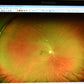 Refurbished Optos California RG AF FFA ICG retinal Camera offered by Visumed Equipment