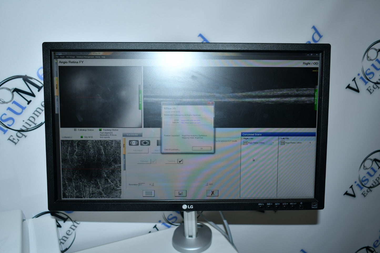 Refurbished Optovue Avanti-Angiovue OCT-A offered by Visumed Equipment
