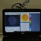Oculus Easygraph Corneal topographer portable and slitlamp mountable