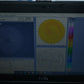 Oculus Easygraph Corneal topographer portable and slitlamp mountable