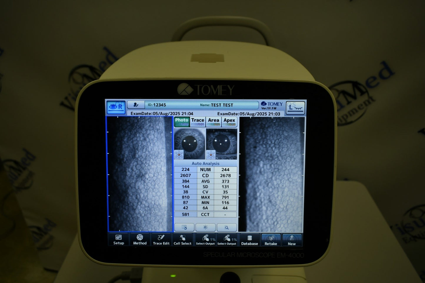 Tomey EM-4000 Specular endothelial microscope