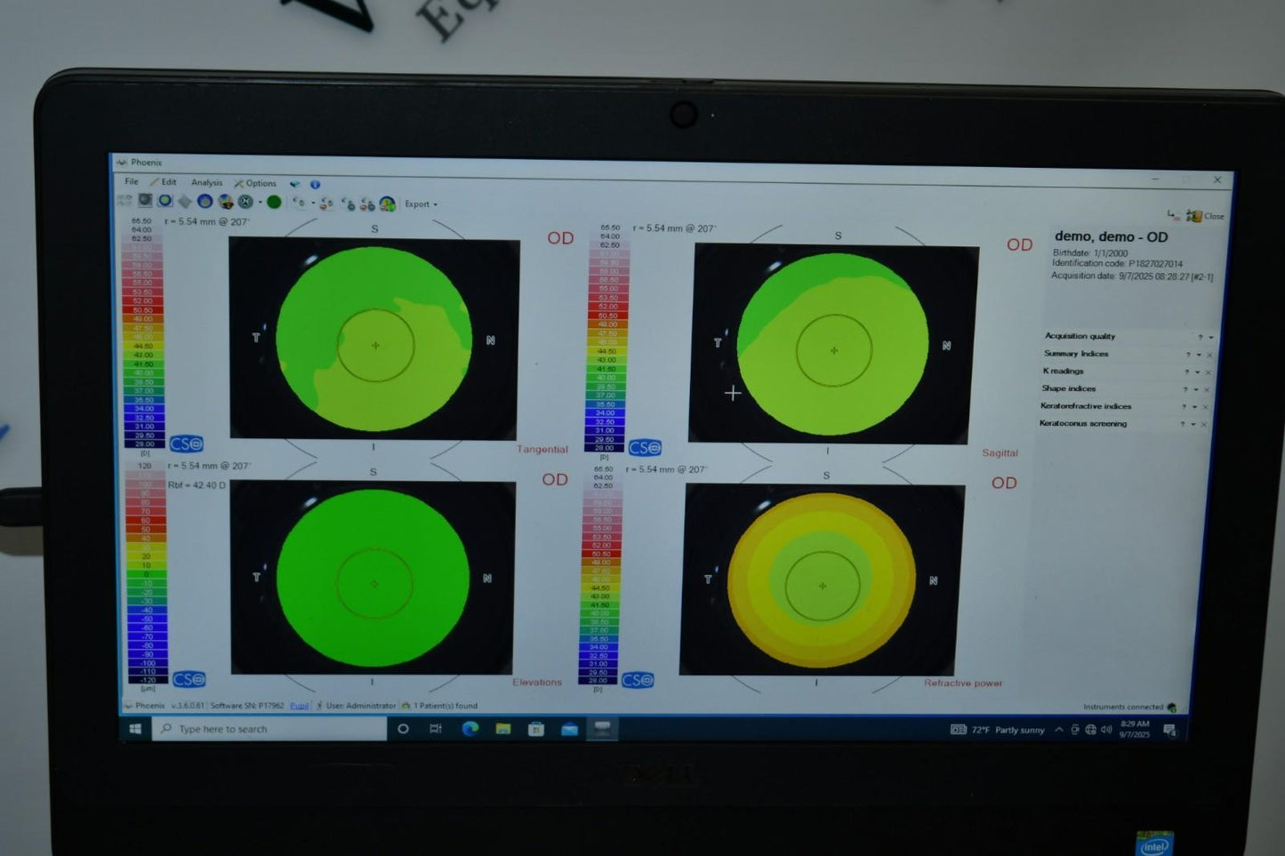 Refurbished Lumenis ANTARES Corneal Topographer offered by Visumed Equipment