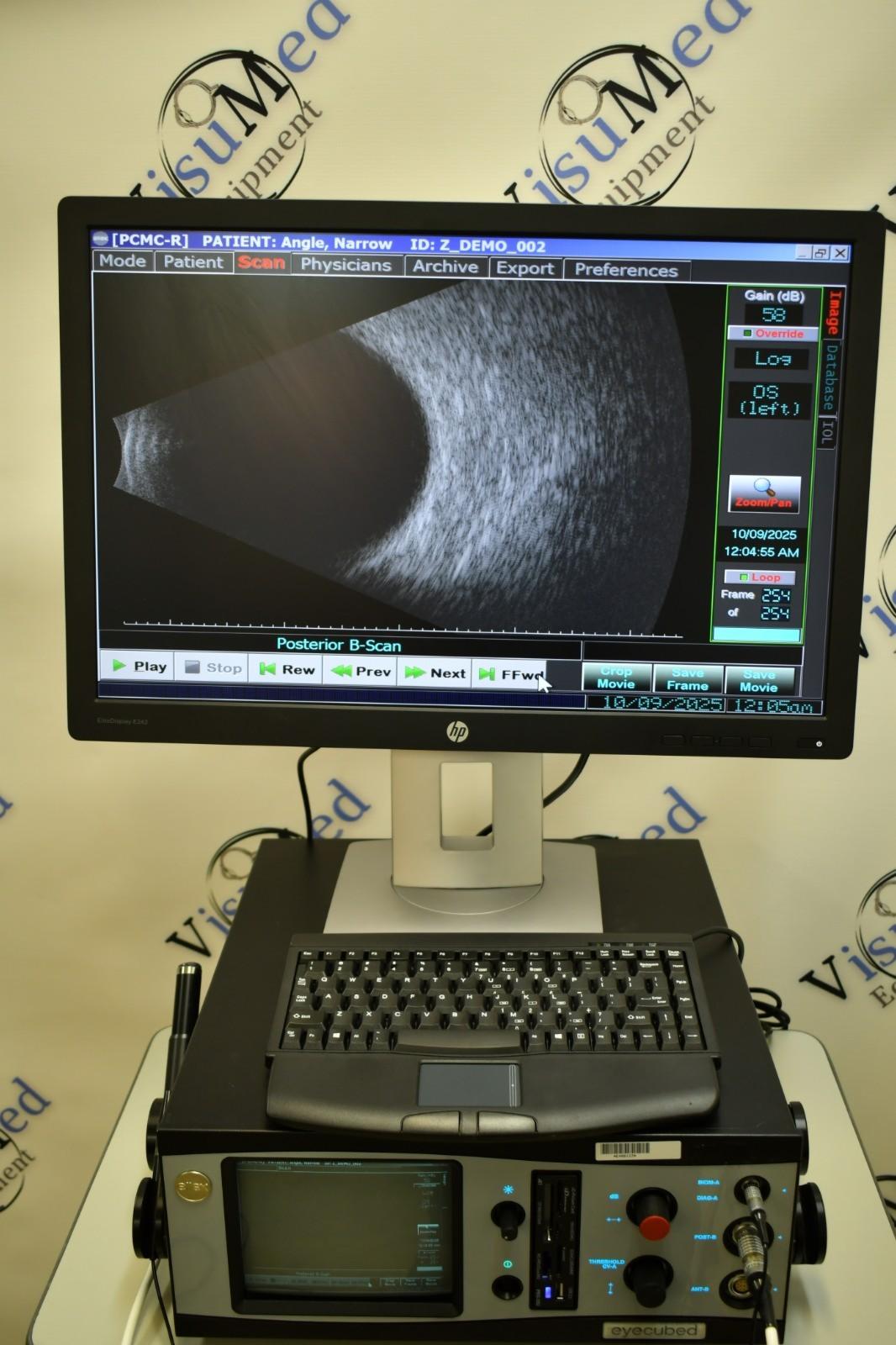 Refurbished Ellex Eyecubed V3 A scan Bscan  Eye Cubed Ultrasound offered by Visumed Equipment