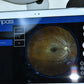 Icare Centervue Compass perimeter fundus camera visual field