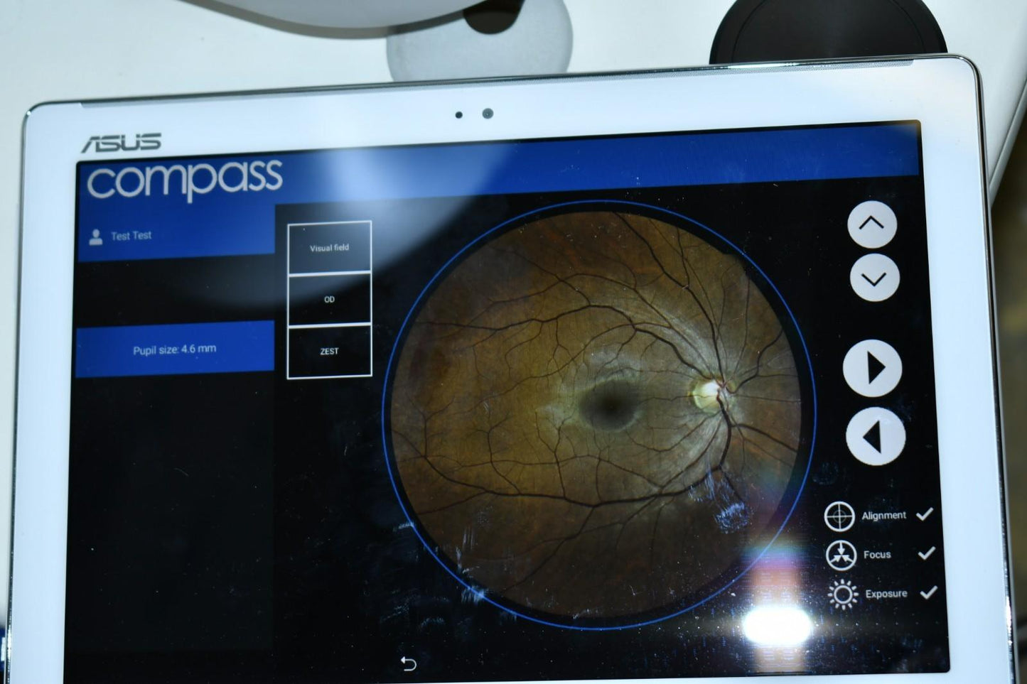 Icare Centervue Compass perimeter fundus camera visual field