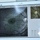Icare Centervue Compass perimeter fundus camera visual field