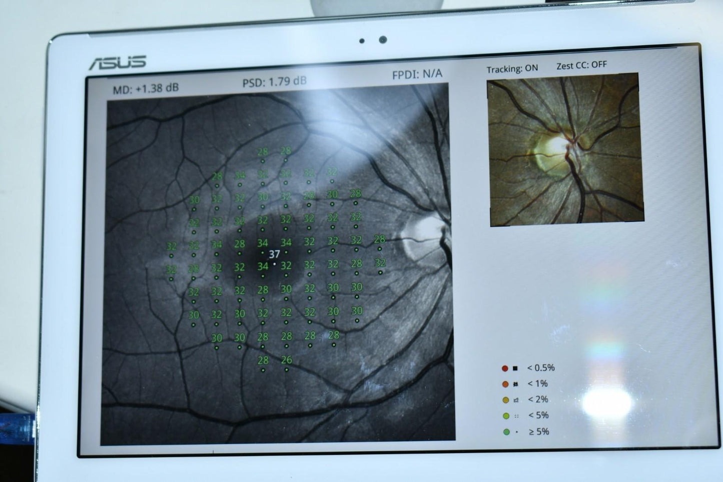 Icare Centervue Compass perimeter fundus camera visual field