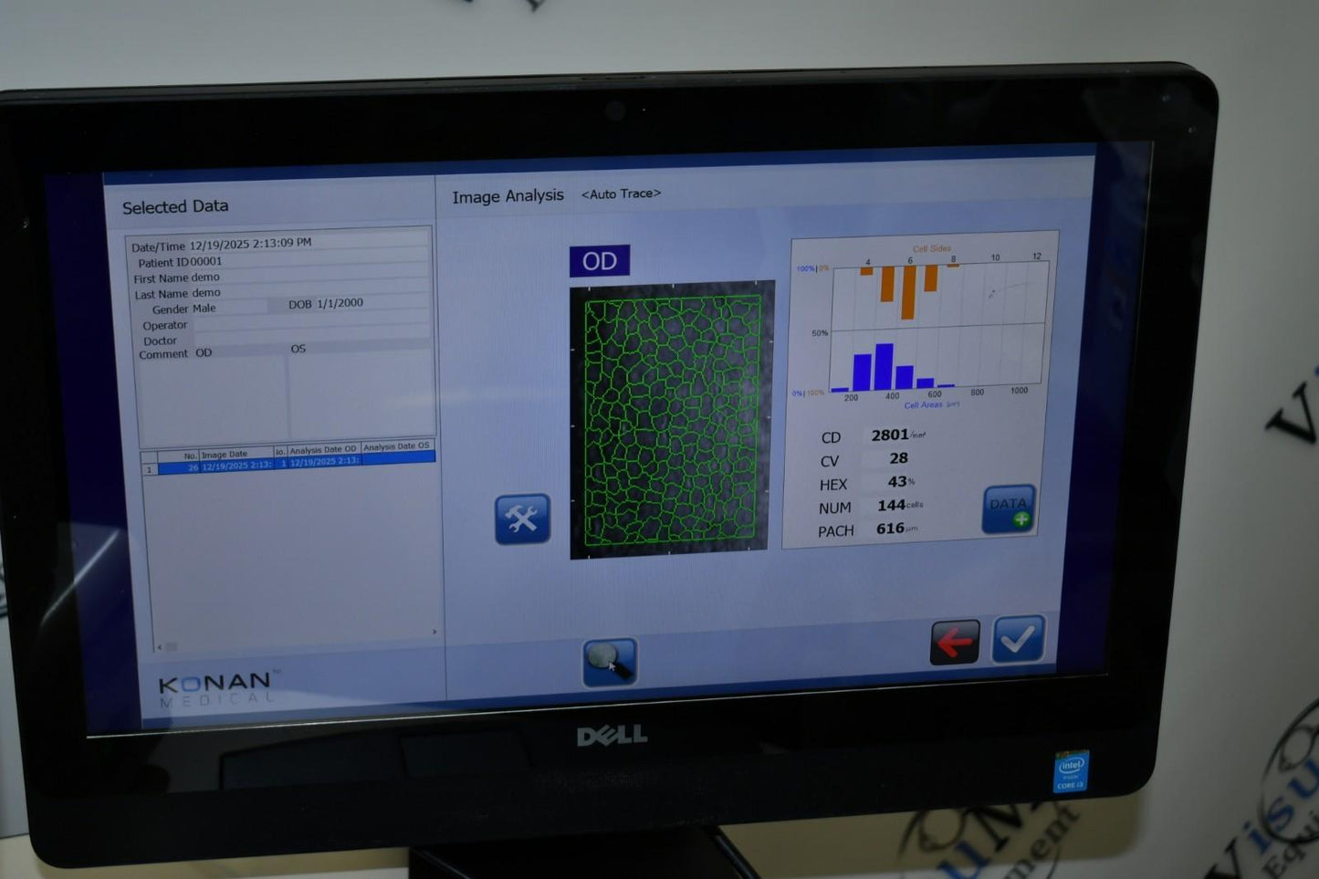 Konan Medical XL win 10 latest software Non-Contact Specular Scope
