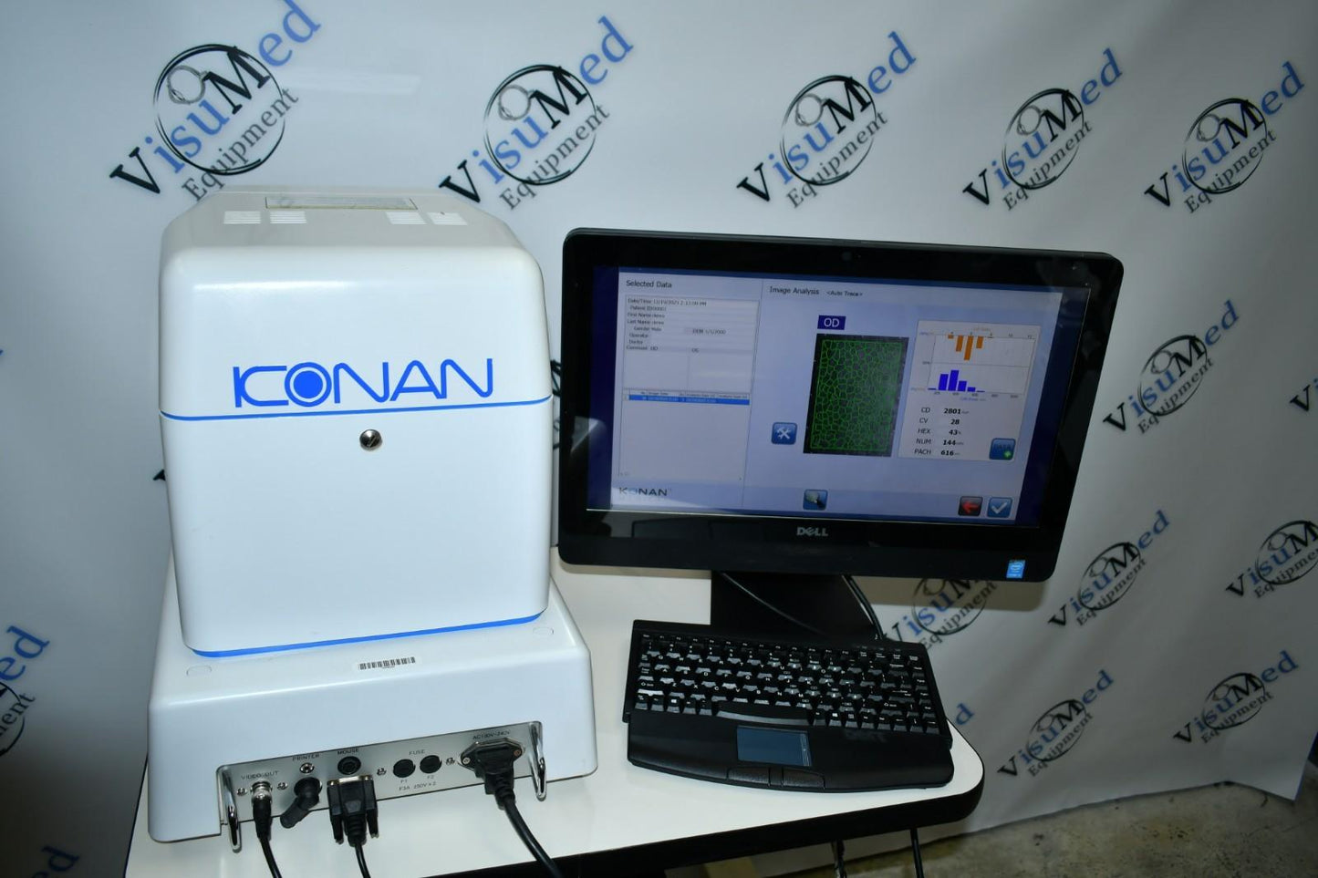 Konan Medical XL win 10 latest software Non-Contact Specular Scope
