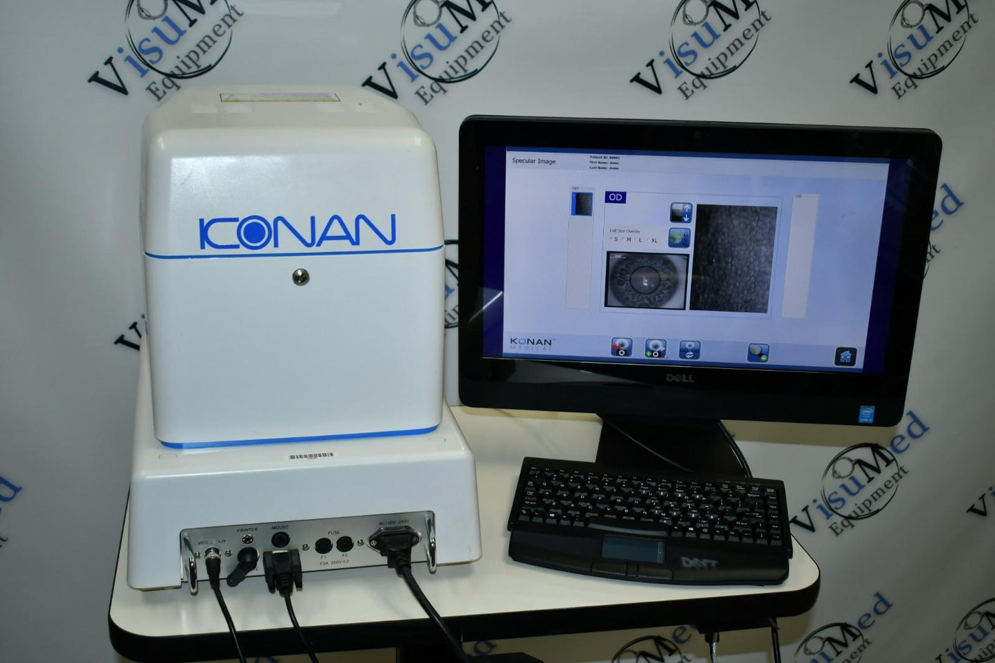 Konan Medical XL win 10 latest software Non-Contact Specular Scope