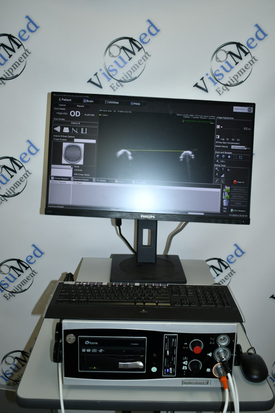 Ellex V4 Eye cubed B-scan UBM ophthalmic ultrasound