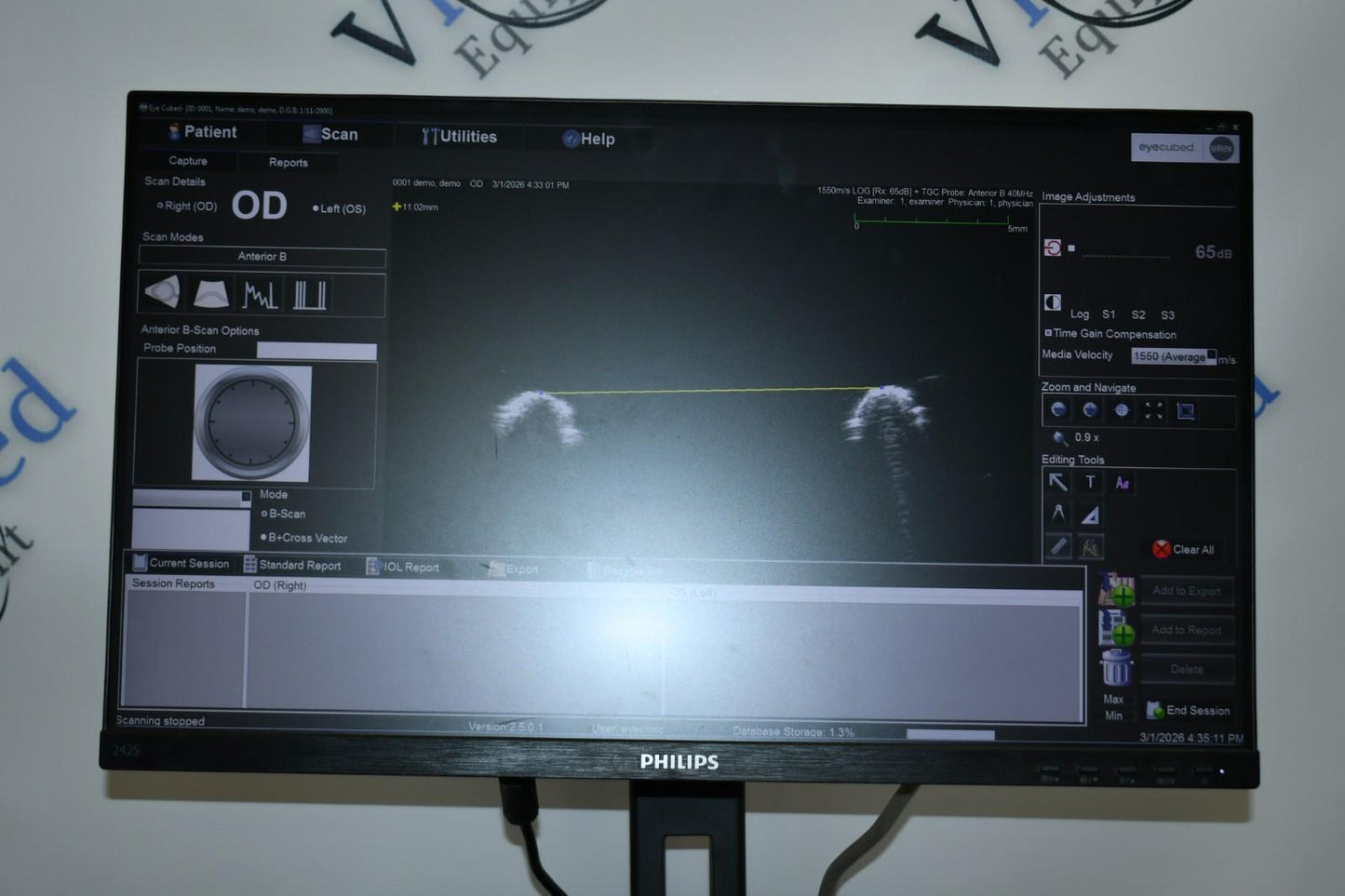 Ellex V4 Eye cubed B-scan UBM ophthalmic ultrasound