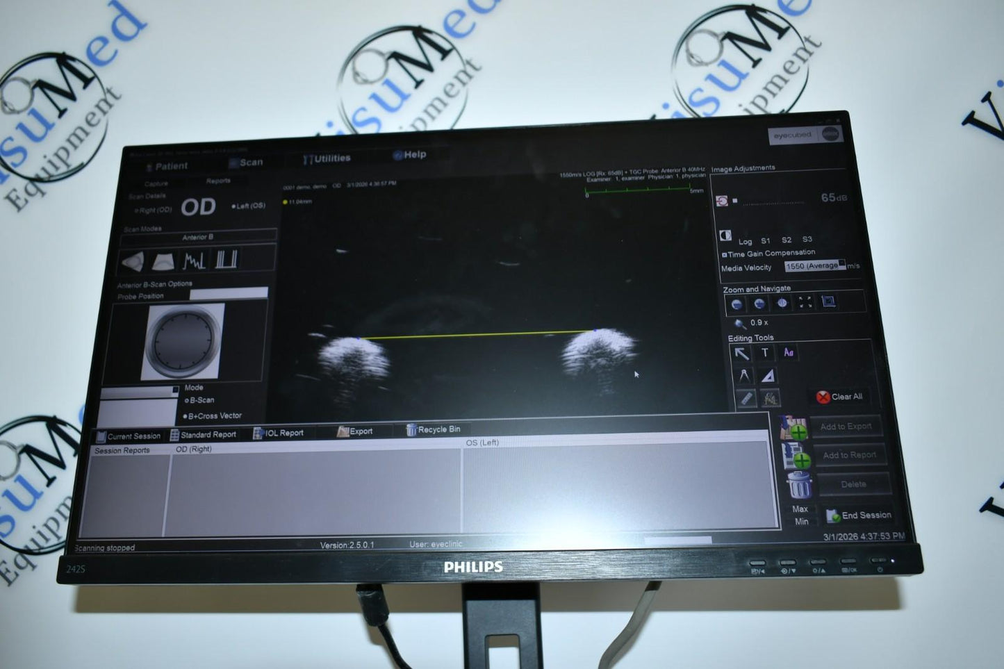 Ellex V4 Eye cubed B-scan UBM ophthalmic ultrasound