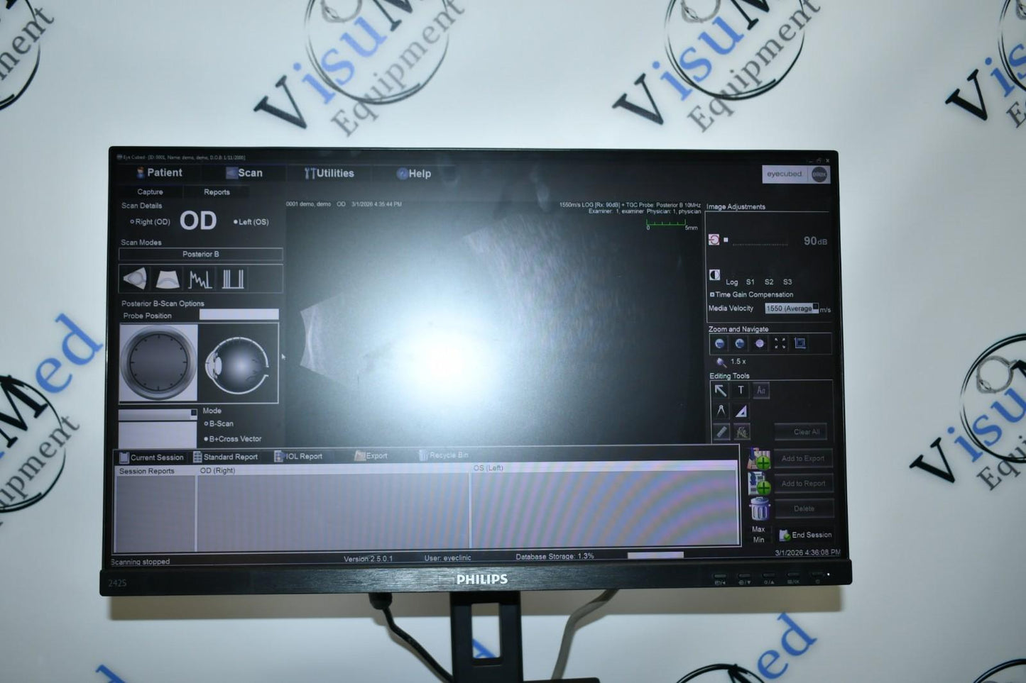 Ellex V4 Eye cubed B-scan UBM ophthalmic ultrasound